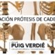 fijación de prótesis de cadera _Dr. Lluís Puig Verdié_cirugía ortopédica y traumatología