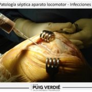 Dr. lluís Puig Verdié especialista en infecciones de prótesis, hueso y articulaciones