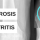 Diferencia entre artrosis y artritis por el Dr. Lluís Puig Verdié traumatólogo experto en prótesis de rodilla y cadera en Barcelona post