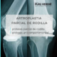 artroplastia parcial de rodilla por el Dr. Lluís Puig Verdié experto en prótesis de rodilla en Barcelona