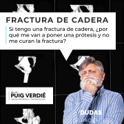 en una fractura de cadera cuándo se pone una prótesis por el Dr. Lluís Puig Verdié traumatólogo experto en cirugía de cadera