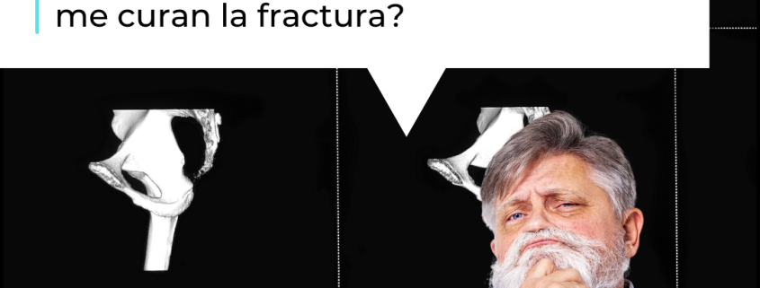 en una fractura de cadera cuándo se pone una prótesis por el Dr. Lluís Puig Verdié traumatólogo experto en cirugía de cadera
